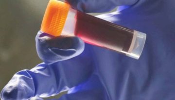 Μια ομάδα αίματος έχει μεγαλύτερο κίνδυνο για διαβήτη τύπου 2