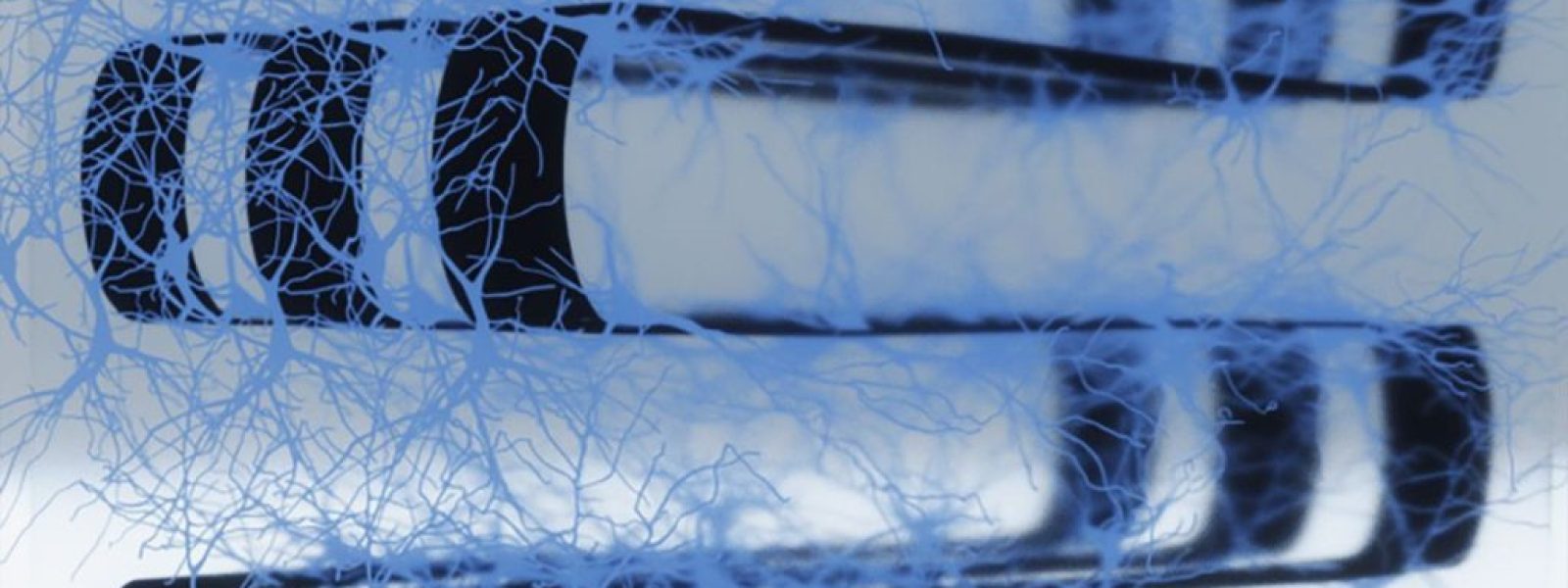 3D βιο-υπολογιστής με 70.000 ζωντανούς νευρώνες μειώνει την ενεργειακή κατανάλωση της AI